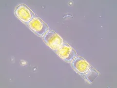 Eupyxidicula turris thumbnail 1