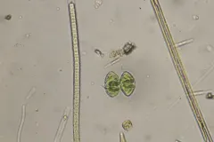 Staurastrum punctulatum thumbnail 1