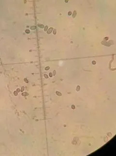Caulorhiza hygrophoroides thumbnail 3