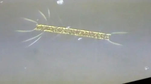 Chaetoceros didymus