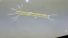 Chaetoceros didymus thumbnail 1