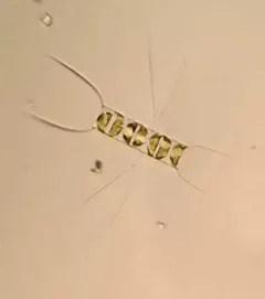 Chaetoceros didymus thumbnail 4