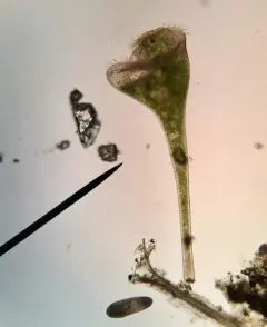 Stentor polymorphus thumbnail 3