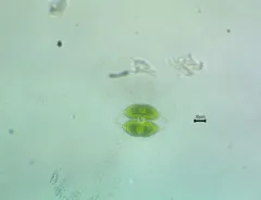 Staurodesmus convergens thumbnail 3