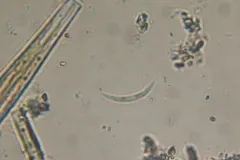 Monoraphidium arcuatum thumbnail 2