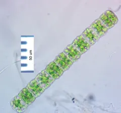 Hyalotheca dissiliens thumbnail 3