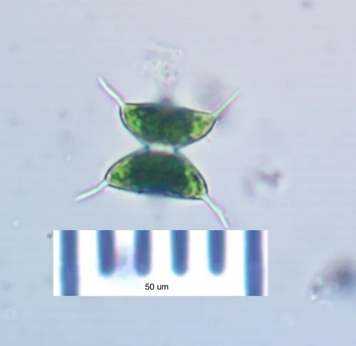 Staurodesmus validus