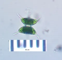Staurodesmus validus thumbnail 1