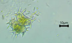 Staurastrum hystrix thumbnail 1