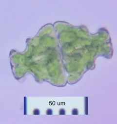 Euastrum ampullaceum thumbnail 3