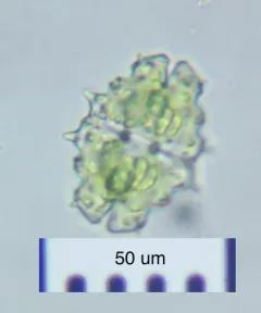 Euastrum divaricatum thumbnail 1