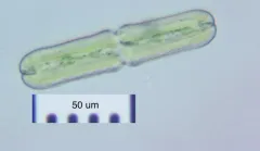 Tetmemorus brebissonii thumbnail 3