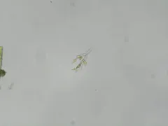 Dinobryon divergens thumbnail 4