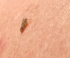 Macropsis bifasciata thumbnail 2