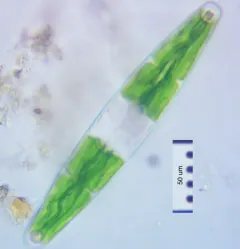 Closterium closterioides thumbnail 2