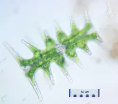 Micrasterias muricata thumbnail 4