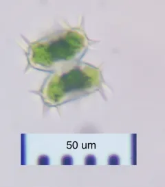 Staurastrum hystrix thumbnail 2