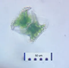 Staurastrum cerastes thumbnail 2
