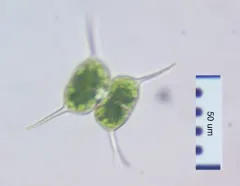 Staurodesmus bulnheimii thumbnail 2