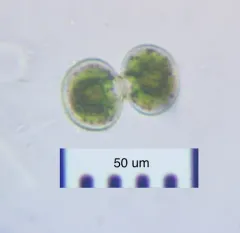 Cosmarium contractum thumbnail 3
