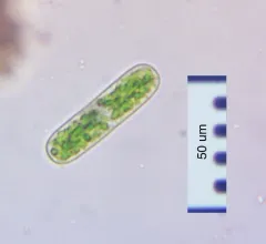Cylindrocystis brebissonii thumbnail 2
