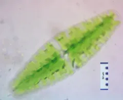 Netrium digitus thumbnail 3