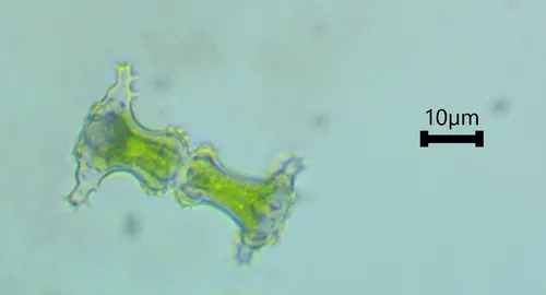 Staurastrum elongatum