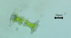 Staurastrum elongatum thumbnail 1
