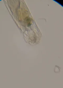 Cephalodella forficula thumbnail 1