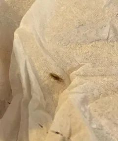 Human Louse thumbnail 3