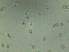 Pluteus deceptivus thumbnail 1