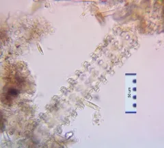 Triploceras verticillatum thumbnail 3