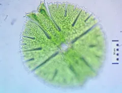 Micrasterias rotata thumbnail 4