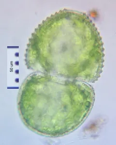Cosmarium ovale thumbnail 1