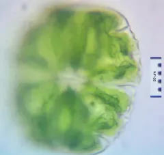 Micrasterias truncata thumbnail 4