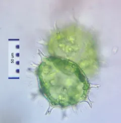 Xanthidium armatum thumbnail 3