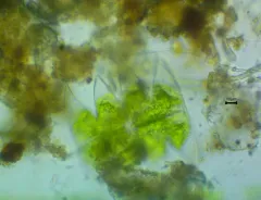 Micrasterias laticeps thumbnail 4