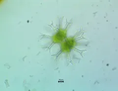 Staurastrum arctiscon thumbnail 1