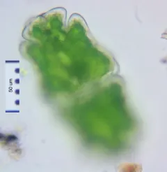 Euastrum crassum thumbnail 2