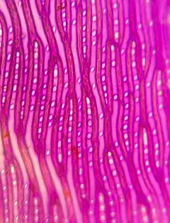 Largeleaf Peatmoss thumbnail 4