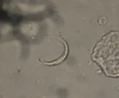 Monoraphidium contortum thumbnail 2