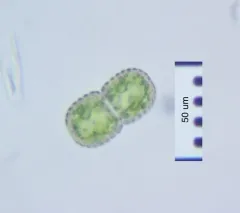 Cosmarium amoenum thumbnail 4