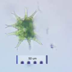 Staurastrum furcigerum thumbnail 2