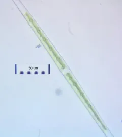 Closterium aciculare thumbnail 1