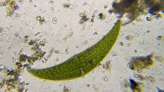 Closterium ehrenbergii thumbnail 1