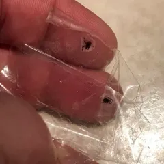 Eastern Black-legged Tick thumbnail 2