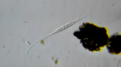 Amphileptus procerus
