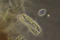 Cocconeis pediculus thumbnail 4