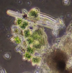 Pediastrum duplex thumbnail 2