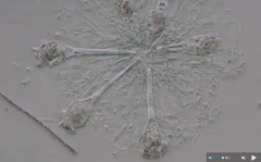 Sheathed Rotifer thumbnail 2